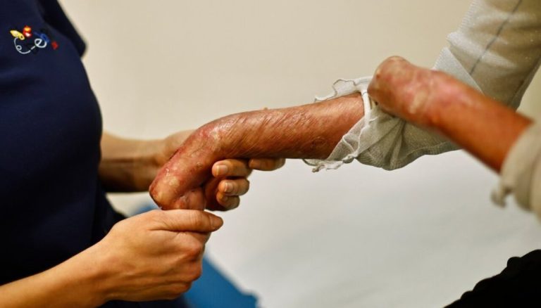 [Entrevista] Mes del niño y niña piel de Cristal: Fundación Debra realiza colecta para centro médico